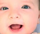 Pediatric Posterior Optic Capture