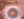 Figure. The patient’s eye prior to surgery.