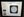 Figure 3. Screen view of an RK patient focusing on the lens. Note that, even with good dilation, care has be taken to expose the whole IOL.