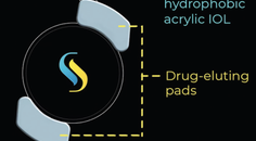 The SpyGlass Pharma Drug Delivery Platform