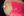 Figure 1. On initial presentation, there was evidence of a scleral nodule with inflammation and possible infection. A bacterial infection was presumed.