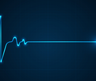 Case Study When the Heart Skips a Beat