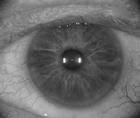 The Current Cataract Refractive Landscape