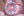 Figure 8. The Utrata forceps were used to enlarge the
capsulorhexis.