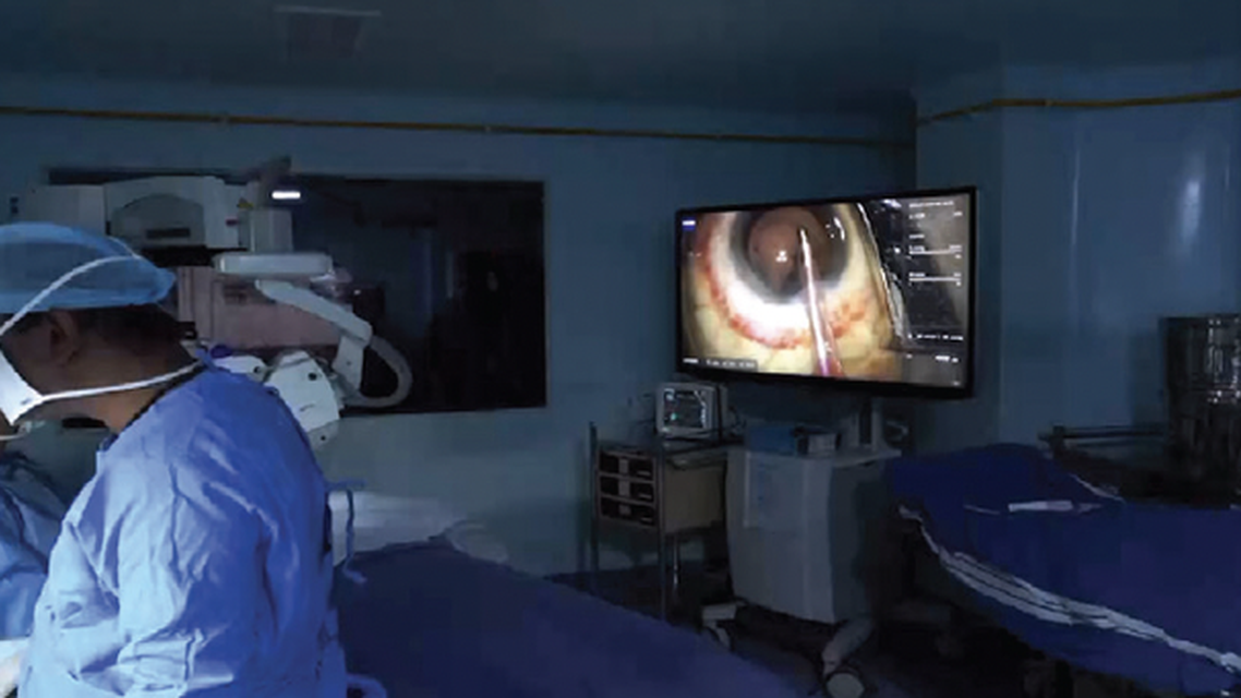 Integrated Cataract Workflow In My OR