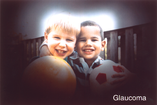 New Survey From Bausch + Lomb and Glaucoma Research Foundation Reveals Emotional and Social Impact of Hyperemia on Glaucoma P