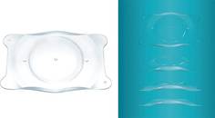 Is the Future of Refractive Surgery Lens based