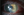 Figure 1. Paracentral ulceration involving the LASIK flap.