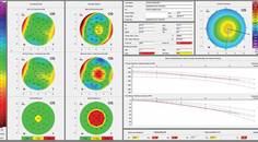 Keratoconus Pediatric Prevalence and a New Treatment Option