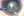 Figure 2. Laser cataract surgery on an eye with a grade 4+ white cataract. The cubed fragments are removed.