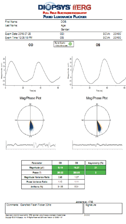 Evaluating the Retina Before Cataract Surgery
