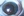 Figure 6. CapsuLaser anterior capsulotomy created through
a phakic IOL in a patient scheduled for cataract surgery.