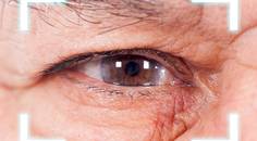 Cataract Surgery After SMILE