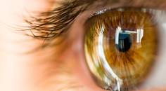 Initial Results With Allograft Corneal Inlays