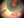 Figure 4. The finished suture fixes the capsulorhexis edge
to the posterior surface of the iris.
Courtesy of Garry P. Condon, MD