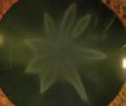 Star Shaped Cataract