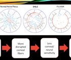 Corneal Considerations for Refractive Surgery Procedures