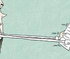 Corneal Inlays a Clinical Primer
