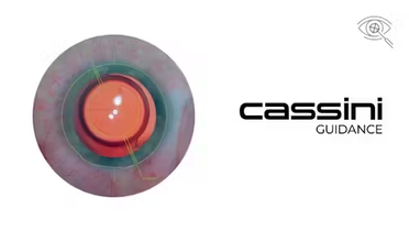 Cassini and Leica Microsystems Collaborate to Enhance Intraoperative Guidance for Cataract Surgery image
