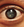 Figure 1. Fluid-filled clefts in the lens of the left eye.