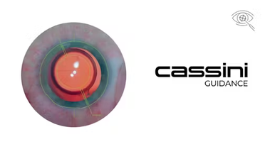 Cassini Guidance System Receives MDR Approval, Launches Across European Union image