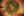 Figure 4. A double-needle technique developed by John C. Hart Jr, MD, allows more peripheral placement of iris sutures and reduces the risk of creating an oval pupil.