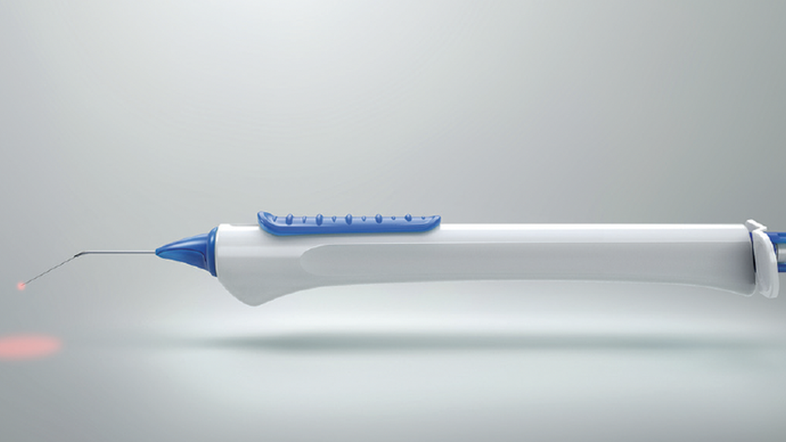 The Opportunity in Canaloplasty