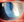 Figure 1. Haze is evident in the right eye at the slit lamp.