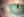 Figure 3. Comparative external photo after multiple rounds of 5-FU. Lesion showed complete resolution following the treatment course.