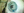 Figure 9. At the end of the case, all incisions were sealed and the OVD was removed. The blue stain of the capsular bag overlying the iris prosthesis confirmed its placement in the bag.
