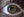 Figure 3. Two years after treatment, the patient’s BCVA was 20/30.