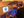 Figure 1. A patient is docked under the VisuMax femtosecond laser.