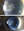 Figure 1. Visually significant SND in the right eye.