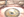 Figure 1. The lenticule is positioned in the center of the cornea.