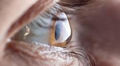 Pearls for Keratoconus Screening and Treatment