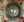 Figure 12. The immediate postoperative
appearance of the eye.