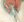 Figure 4. Counterclockwise turning of the lens inserter as the trailing haptic is injected into the ciliary sulcus space.