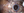 Figure 12. A 5-0 polypropylene suture is threaded through an eyelet, and low-temperature cautery is used to create a large bulb at each end of the lens to prevent slippage through the eyelet.