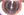 Figure 3. Anterior capsule ovalization in an eye with a plate-haptic IOL.