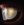 Figure 3. Slit-lamp photograph of an intumescent cataract in the left eye.