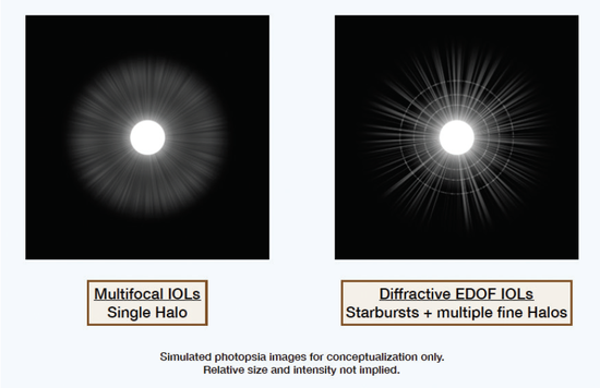 Extended Depth of Focus IOLs: Where Do They Fit?