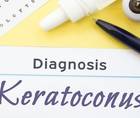 I Underwent CXL to Treat My Keratoconus