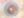 Figure. Traumatic mydriasis, aphakia, and previous scleral tunnel superiorly.
