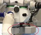 Assessing the CapsuLaser for Primary Posterior Capsulotomy