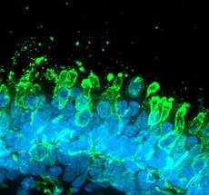 UK-Based Axol Bioscience Acquires Newcells’ Ophthalmology Business image