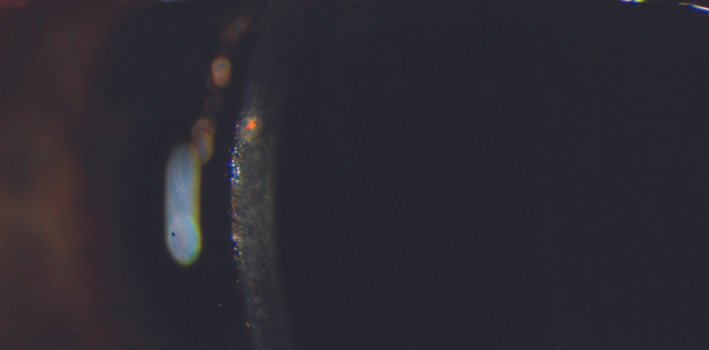 All That Glitters Isnt Gold