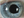 Figure 3. A fixed dilated pupil due to subincisional iridocapsular adhesions in the temporal quadrant following excessive intraoperative tissue trauma.
