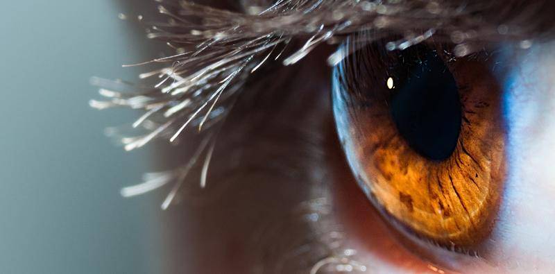 Intermittent Pain and Corneal Scarring
