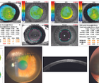 A Love Hate Relationship With the Epithelium