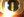 Figure. An IOL with dense glistenings is well positioned in the bag.